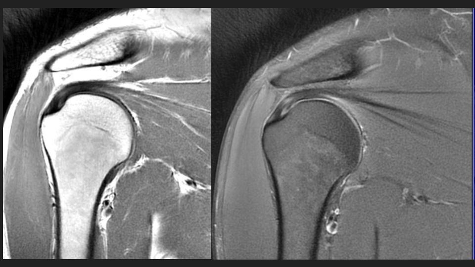 Figure 3 for case dislocation ( RID4770 )